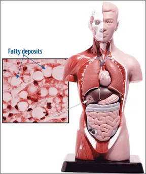 0210-treat-fatty-liver