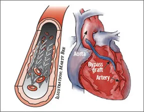 heart_cover_image0707