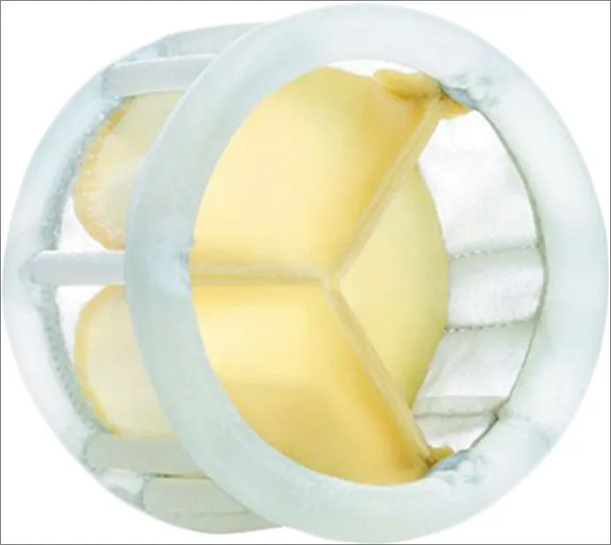 p18vnphfvcpk1ihj1gpms9nna56