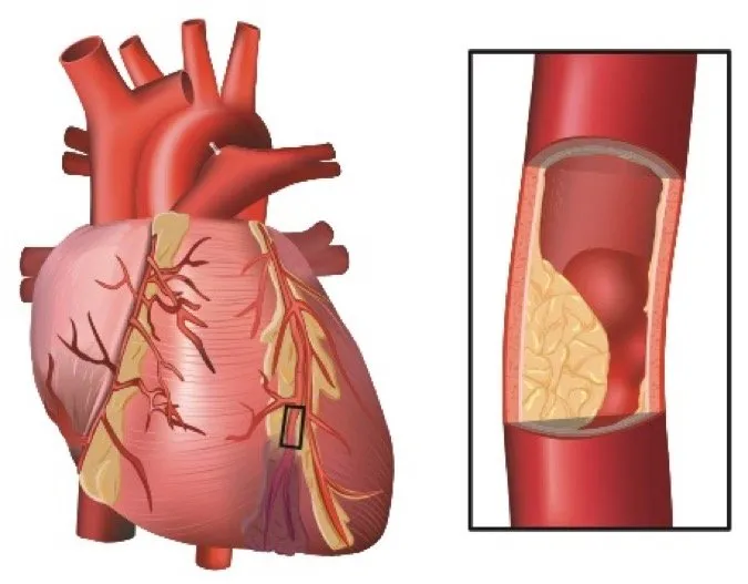 p1br5oi0601mspocmi6u1md21ge16